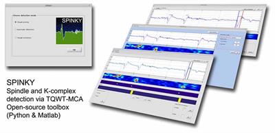 Meet Spinky: An Open-Source Spindle and K-Complex Detection Toolbox Validated on the Open-Access Montreal Archive of <mark class="highlighted">Sleep Studies</mark> (MASS)